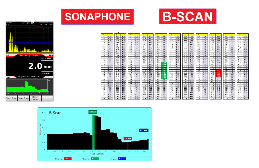 Sonowall 70 B-scan